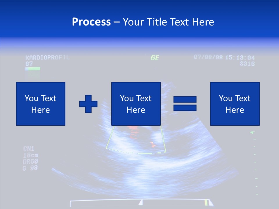 Ultrasound Health Science PowerPoint Template