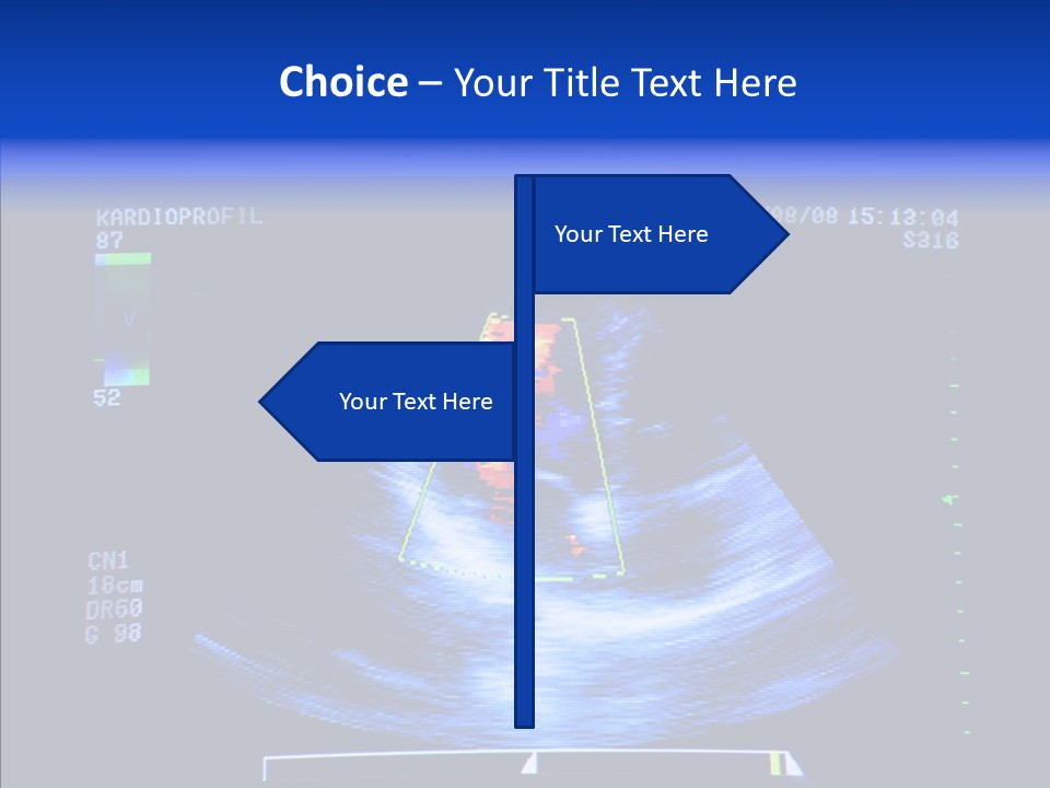 Ultrasound Health Science PowerPoint Template