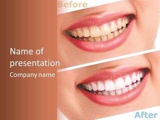 Happiness Creative Concept Tooth PowerPoint Template