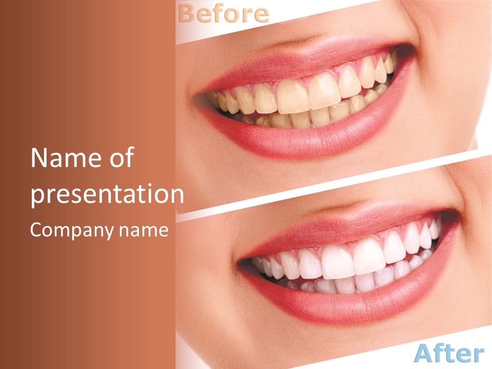 Happiness Creative Concept Tooth PowerPoint Template