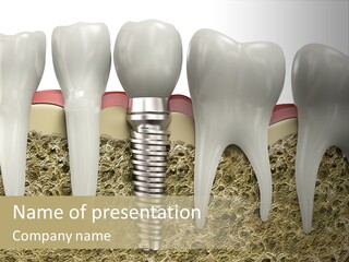 Orthodontist Steel Dentist PowerPoint Template