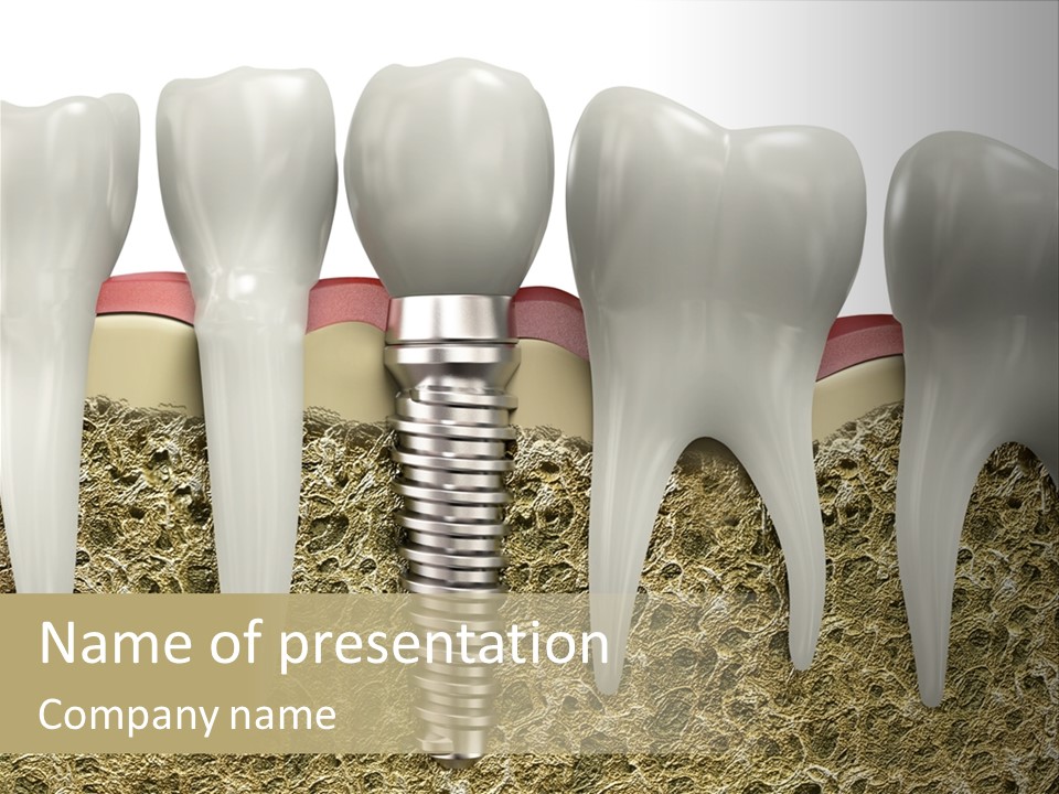 Orthodontist Steel Dentist PowerPoint Template