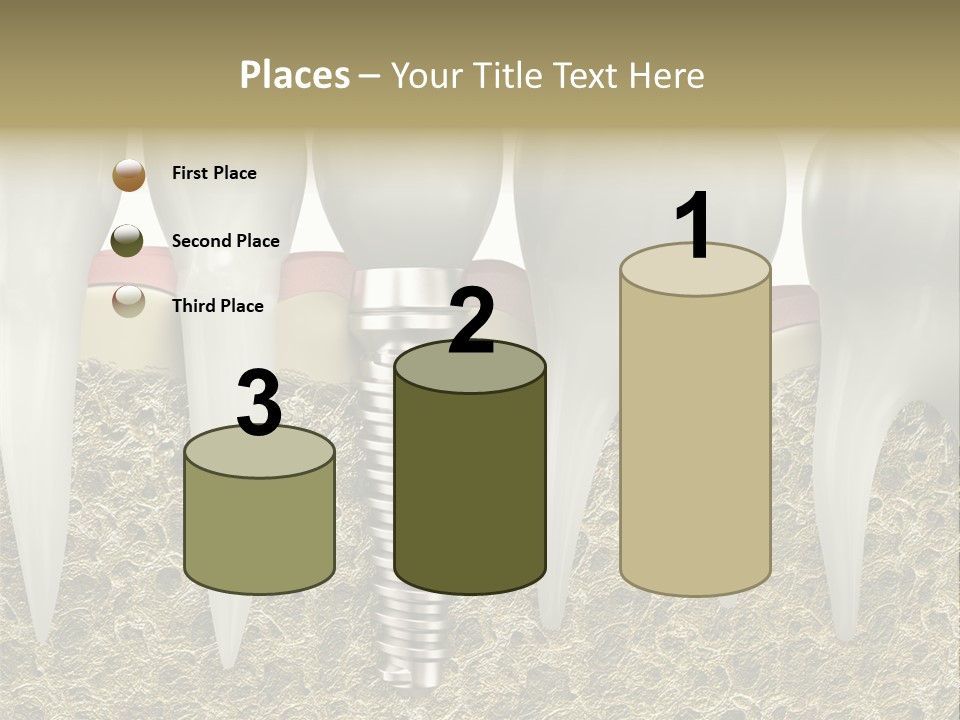 Orthodontist Steel Dentist PowerPoint Template