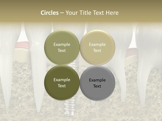 Orthodontist Steel Dentist PowerPoint Template