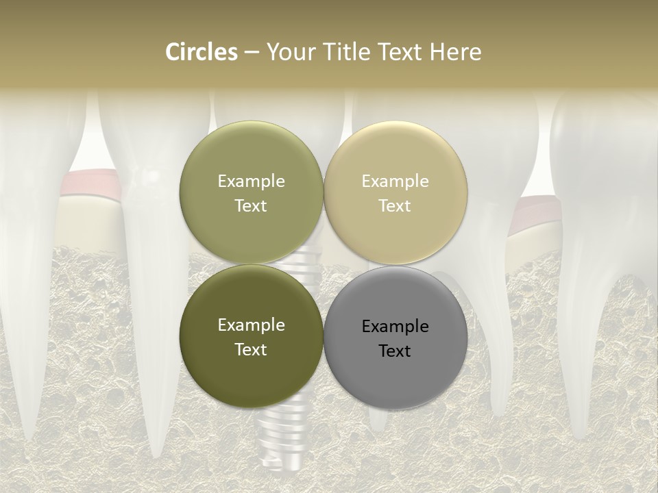 Orthodontist Steel Dentist PowerPoint Template
