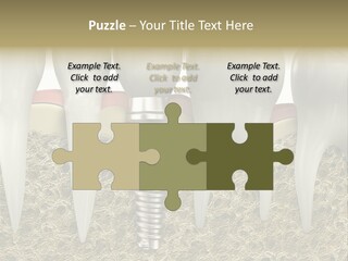 Orthodontist Steel Dentist PowerPoint Template