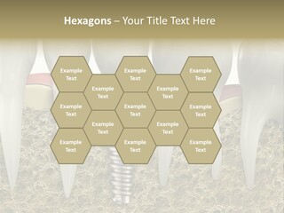 Orthodontist Steel Dentist PowerPoint Template