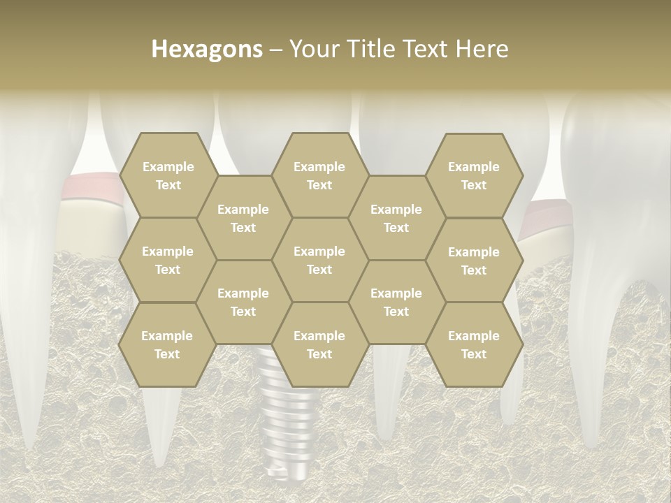 Orthodontist Steel Dentist PowerPoint Template