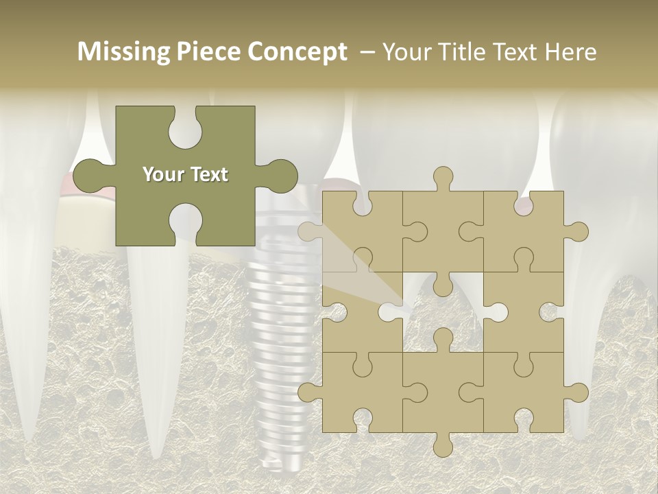 Orthodontist Steel Dentist PowerPoint Template