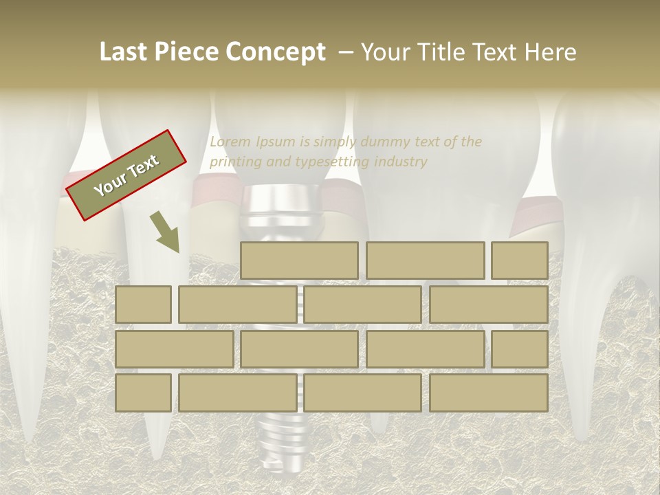 Orthodontist Steel Dentist PowerPoint Template