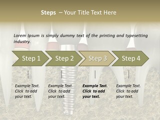 Orthodontist Steel Dentist PowerPoint Template