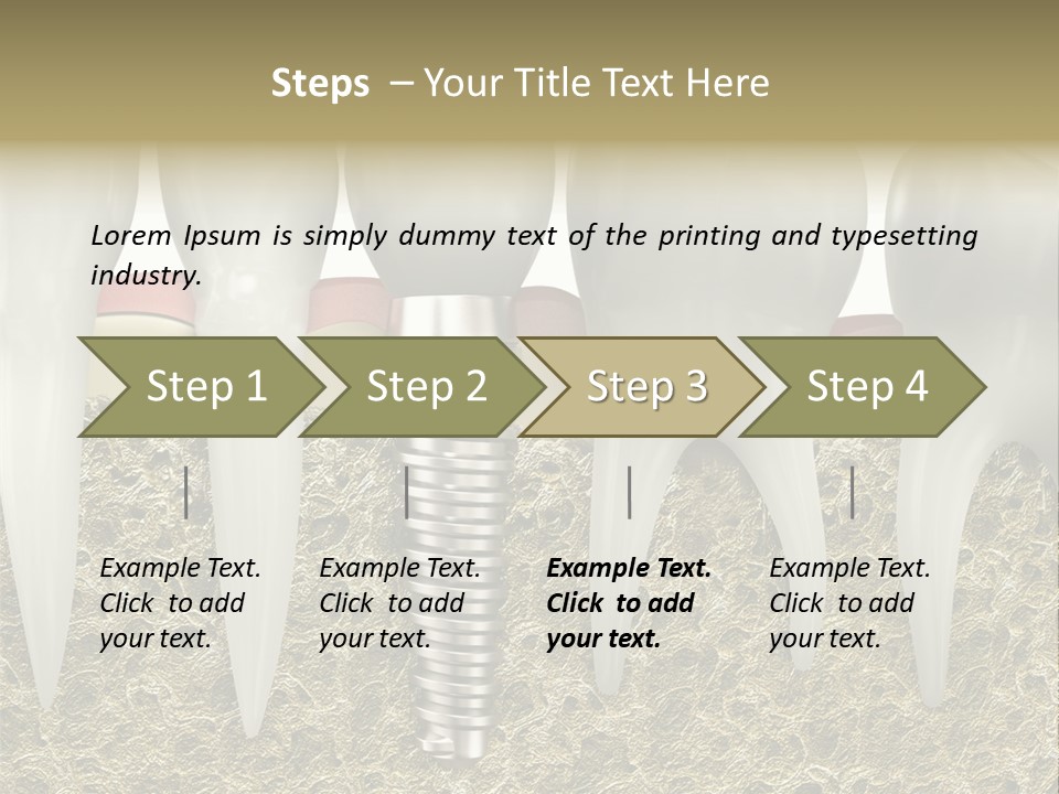 Orthodontist Steel Dentist PowerPoint Template