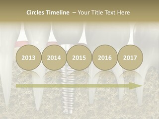 Orthodontist Steel Dentist PowerPoint Template