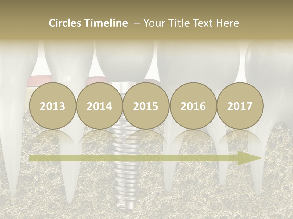 Orthodontist Steel Dentist PowerPoint Template