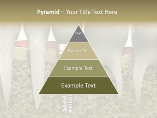 Orthodontist Steel Dentist PowerPoint Template