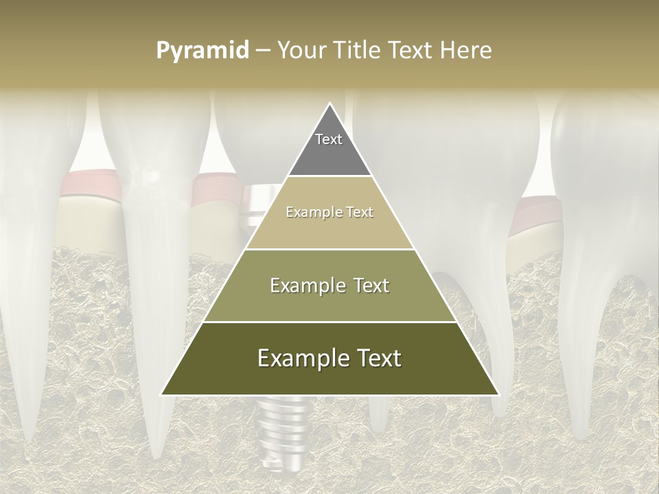 Orthodontist Steel Dentist PowerPoint Template