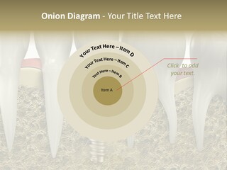 Orthodontist Steel Dentist PowerPoint Template