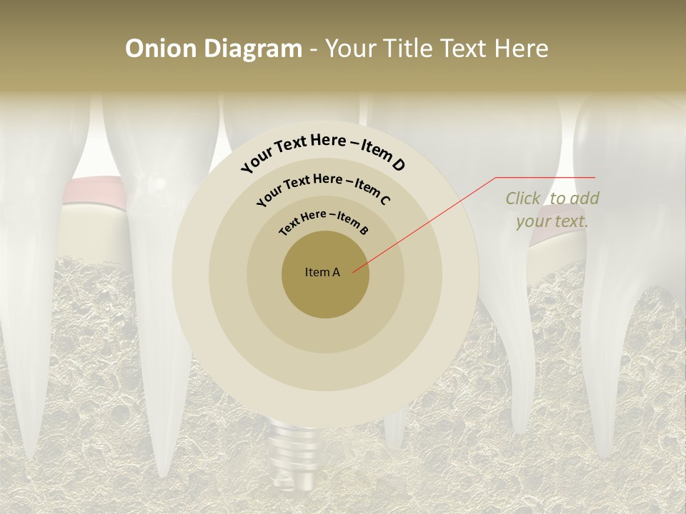 Orthodontist Steel Dentist PowerPoint Template