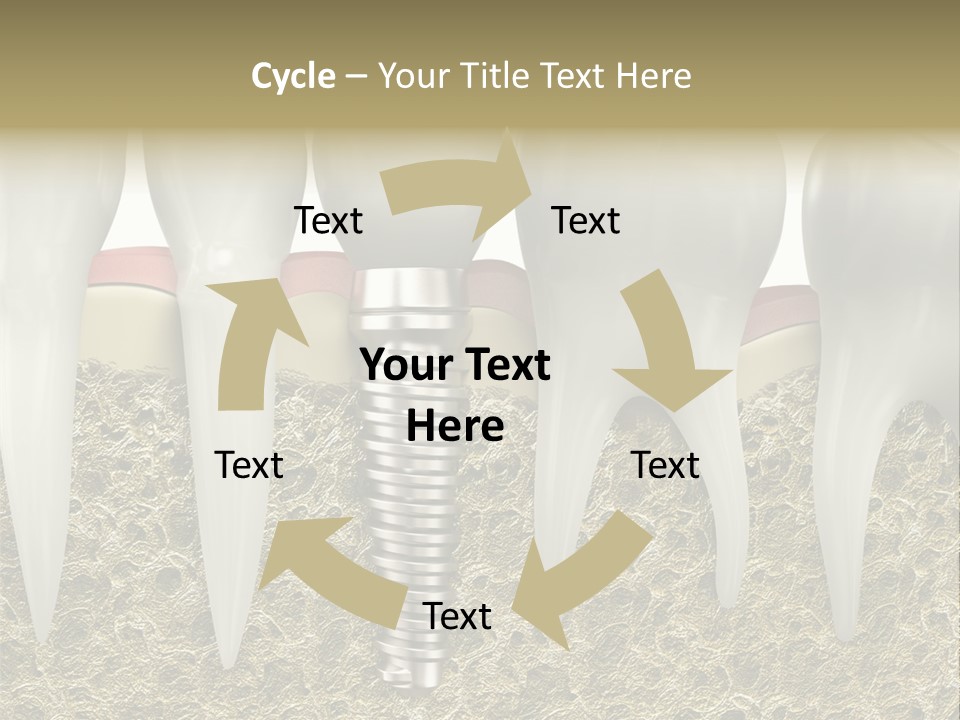 Orthodontist Steel Dentist PowerPoint Template