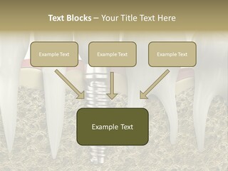 Orthodontist Steel Dentist PowerPoint Template