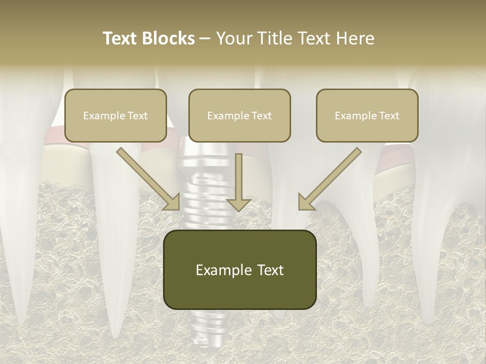 Orthodontist Steel Dentist PowerPoint Template