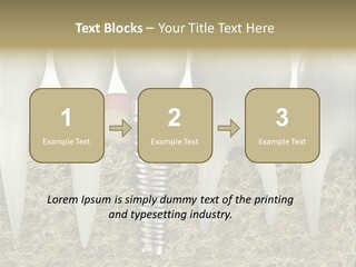 Orthodontist Steel Dentist PowerPoint Template