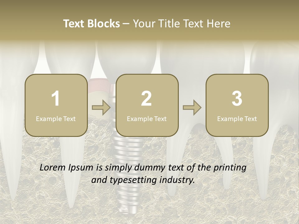 Orthodontist Steel Dentist PowerPoint Template