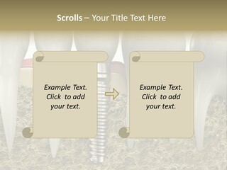 Orthodontist Steel Dentist PowerPoint Template