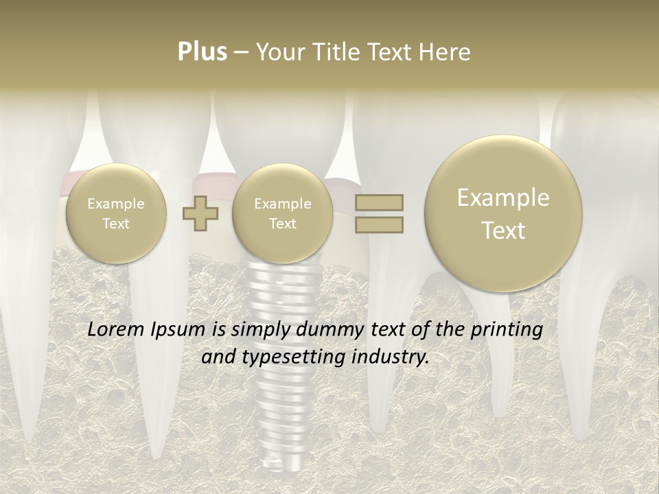 Orthodontist Steel Dentist PowerPoint Template