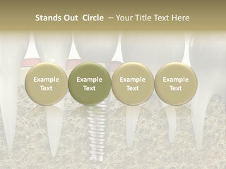 Orthodontist Steel Dentist PowerPoint Template