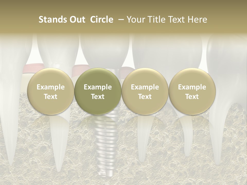 Orthodontist Steel Dentist PowerPoint Template