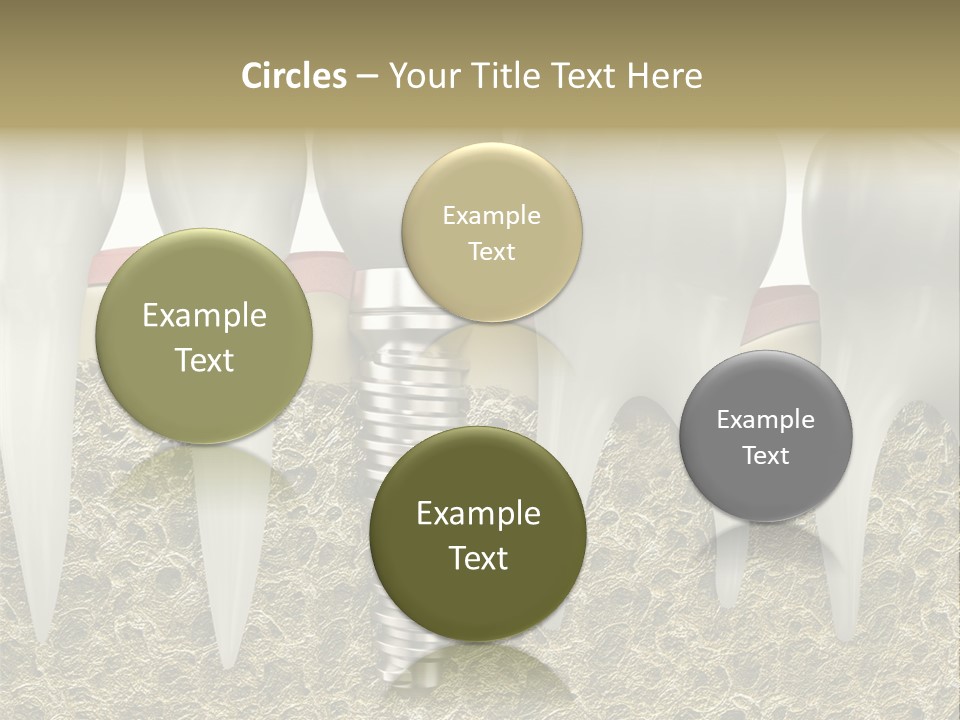 Orthodontist Steel Dentist PowerPoint Template