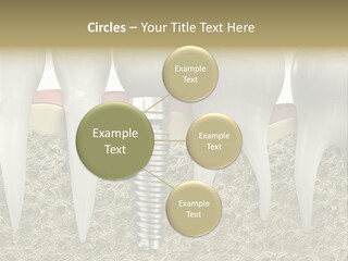Orthodontist Steel Dentist PowerPoint Template