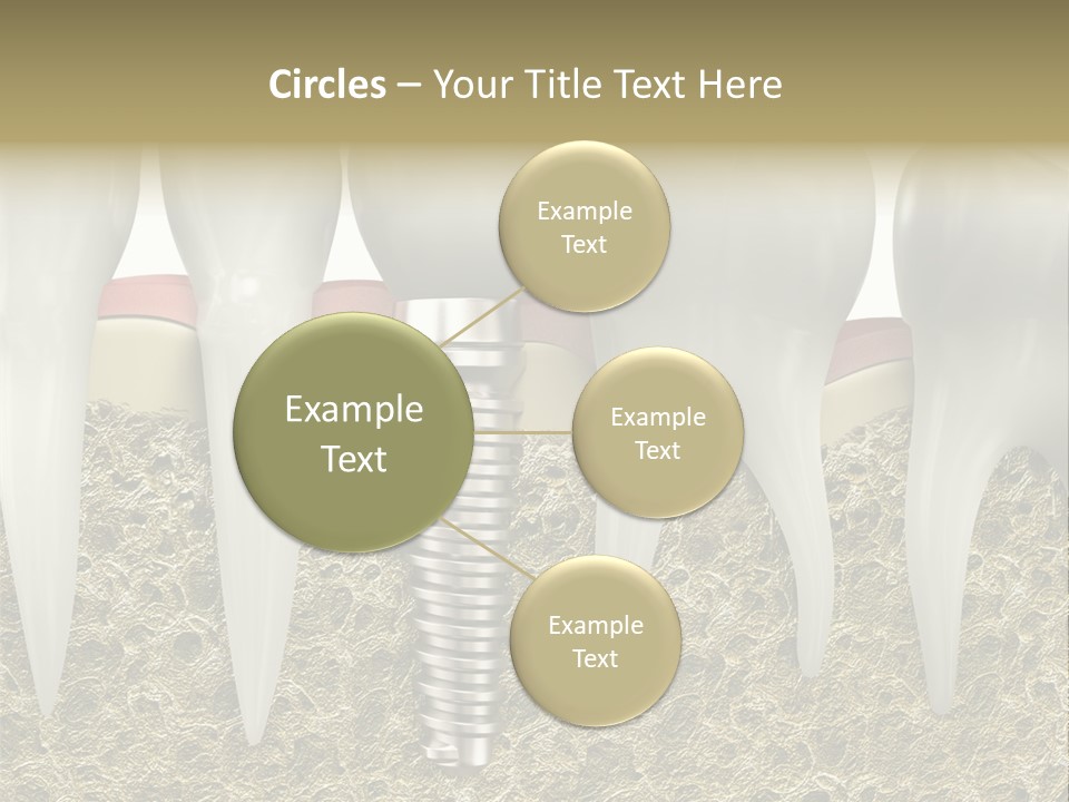 Orthodontist Steel Dentist PowerPoint Template