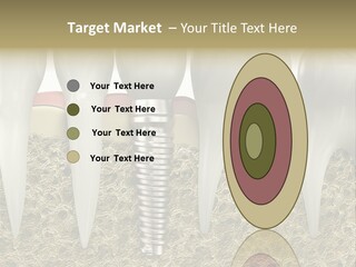 Orthodontist Steel Dentist PowerPoint Template
