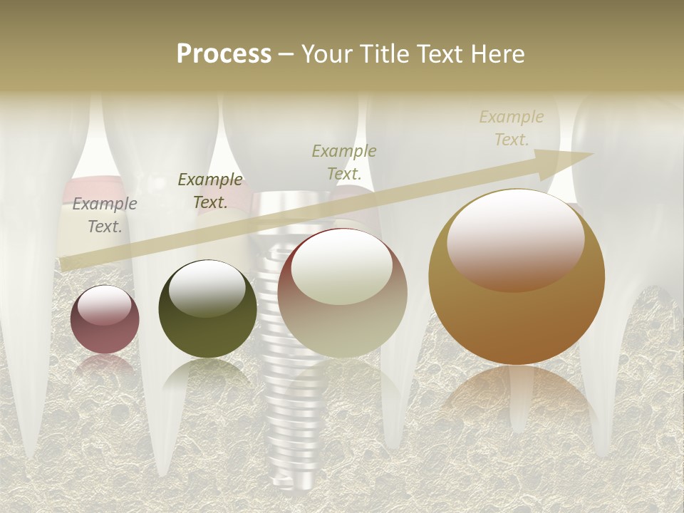 Orthodontist Steel Dentist PowerPoint Template