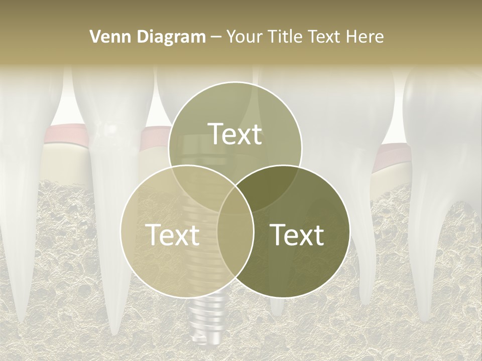 Orthodontist Steel Dentist PowerPoint Template