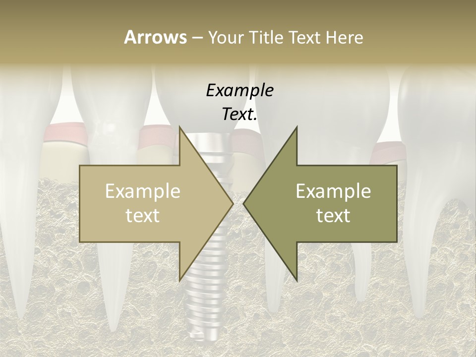 Orthodontist Steel Dentist PowerPoint Template