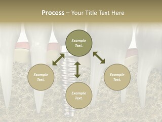 Orthodontist Steel Dentist PowerPoint Template