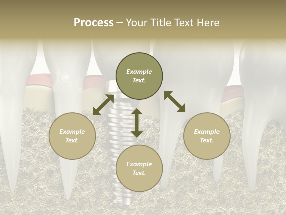 Orthodontist Steel Dentist PowerPoint Template