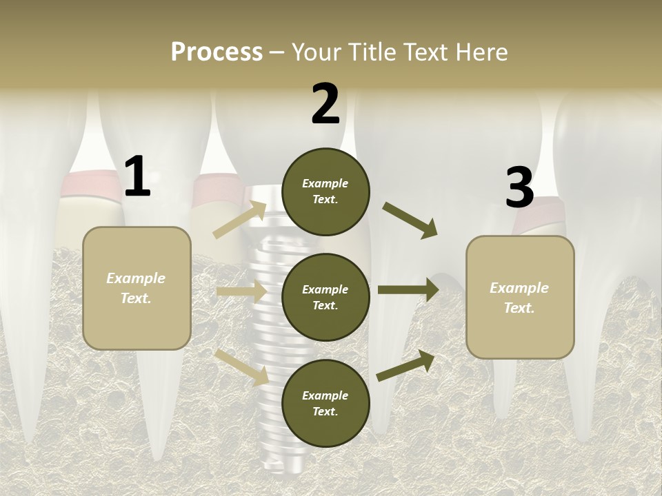 Orthodontist Steel Dentist PowerPoint Template