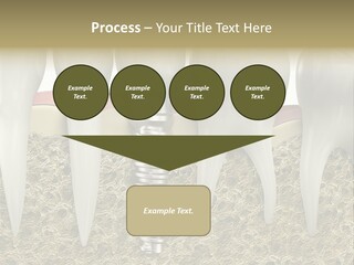 Orthodontist Steel Dentist PowerPoint Template
