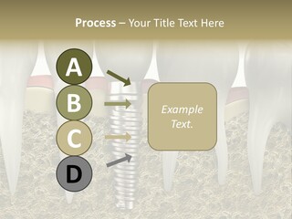 Orthodontist Steel Dentist PowerPoint Template