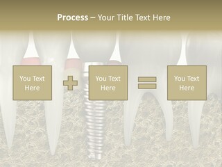 Orthodontist Steel Dentist PowerPoint Template