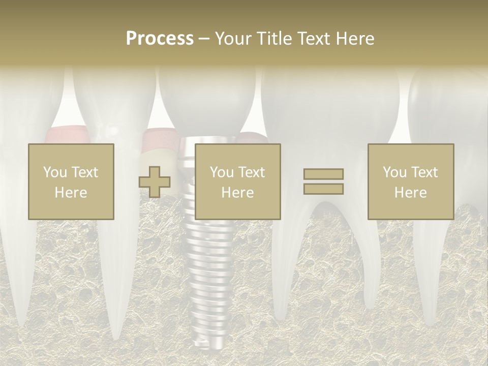 Orthodontist Steel Dentist PowerPoint Template