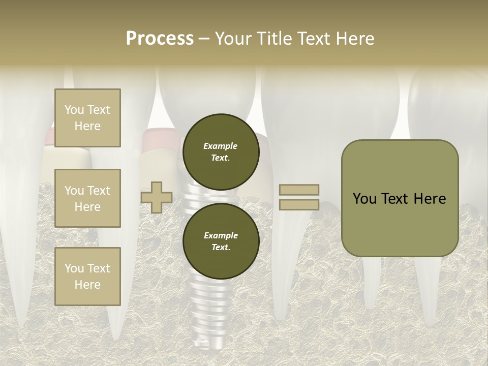 Orthodontist Steel Dentist PowerPoint Template
