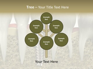 Orthodontist Steel Dentist PowerPoint Template