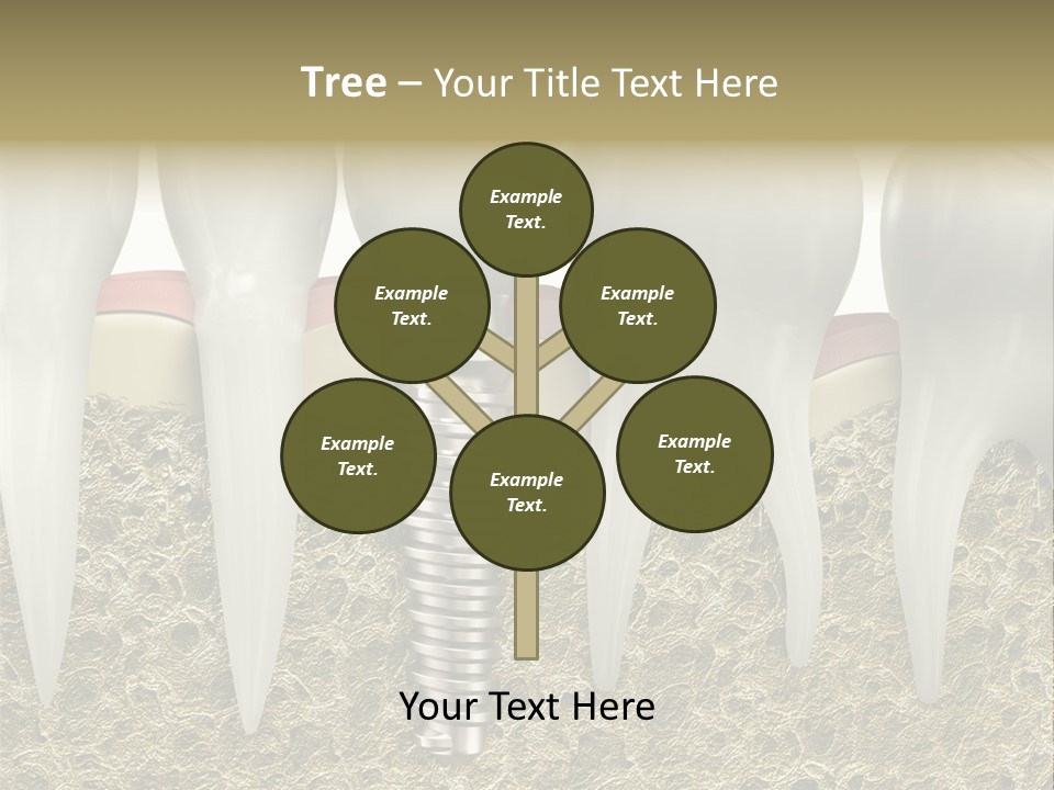 Orthodontist Steel Dentist PowerPoint Template