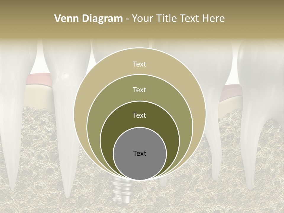 Orthodontist Steel Dentist PowerPoint Template