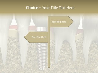 Orthodontist Steel Dentist PowerPoint Template